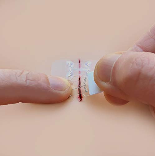 microMend Emergency Wound Closures Surgical Quality Laceration Repair Without Stitches - Think Ahead - Be Prepared - Add to Your Survival Kit, Camping Gear (Emergency Wound Closures)