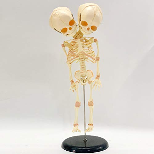 BZZBZZ Human Baby Skeleton Model — Double-Headed Malformation Fetal Newborn Infant Skeleton Anatomical Model for Medical Display Study Teaching