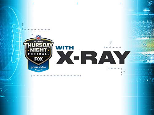 Watch the Game Like Never Before with X-Ray