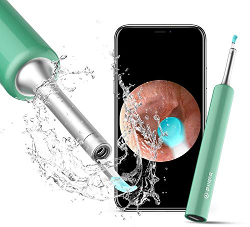 BEBIRD Ear Wax Removal Endoscope, Earwax Remover Tool, Ear Camera,1080P FHD Wireless Ear Otoscope with 6 LED Lights,Ear Scope with Ear Wax Cleaner Tool for iPhone, iPad & Android Smart Phones (Blue)