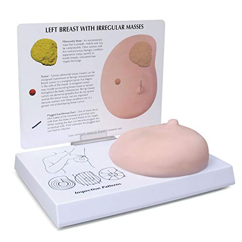 Breast Model | Human Body Anatomy Replica of Breast w/Irregular Masses for Doctors Office Educational Tool | GPI Anatomicals