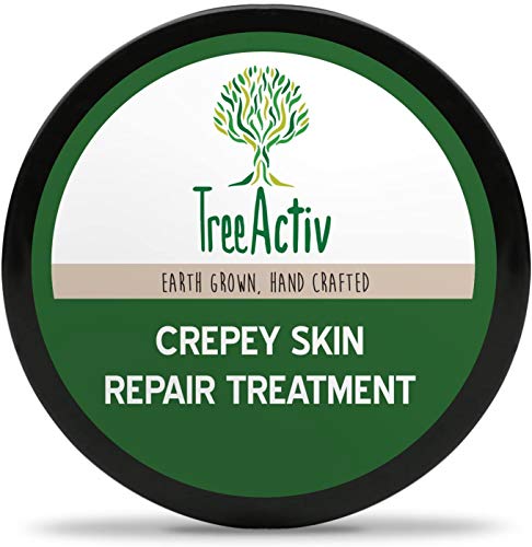 TreeActiv Crepey Skin Repair Treatment, Shea Butter, Honey, Glycolic Acid, Deeply Hydrates, Targets Wrinkles & Fine Lines, Anti-Aging Cream, For Dry, Dull, & Crepey Skin, 8 fl oz (237 ml)