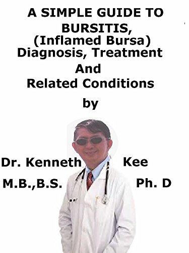 A  Simple  Guide  To  Bursitis, (Inflamed Bursa)  Diagnosis, Treatment  And  Related Conditions