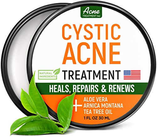 Cystic Acne Treatment and Acne Scar Remover - Made in USA - Effective Face & Body Severe Acne Cleanser with Tea Tree Oil - Prevent Future Breakouts - Natural Acne Spot Pimple Cream - 1 fl.oz