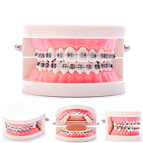 Easyinsmile Dental Orthodontic Model Teeth Model with Metal Bracket Tooth Model with Brace for Patients Communication