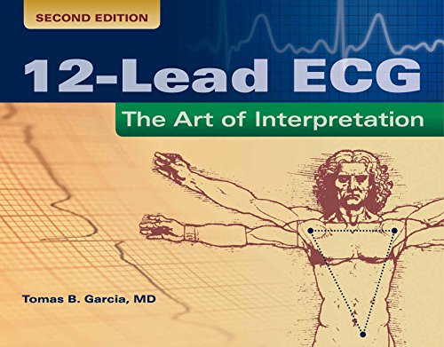 12-Lead ECG: The Art of Interpretation (Garcia, Introduction to 12-Lead ECG)
