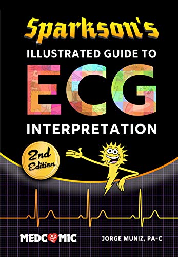 Sparkson's Illustrated Guide to ECG Interpretation, 2nd Edition